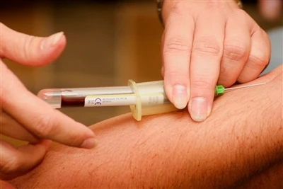 Spinalna igla + proizvođač: trendovi u industriji i izgledi za buduće izazove